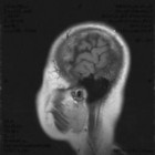 Copy_of_brain0007