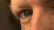 Tony_tasset_eye