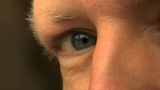 Tony_tasset_eye