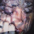 Torn_30x40_2009_web