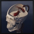 Beetlebrowskull