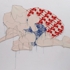 Thrombosenkelch