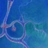 Bronchialtubes