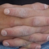 Sorrentohands6