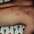 My_balls_6
