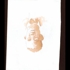 Gin11