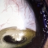 4x6_inch_eye2_copy