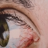 4x6_inch_eye4_copy