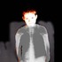 X-ray_1