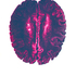 21_new_brain
