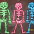 3_dead
