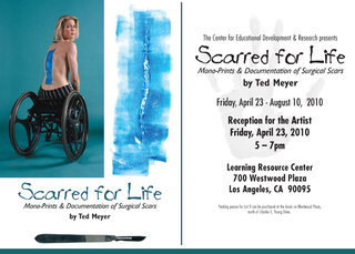 Scarred for Life,Ted Meyer