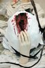 Metastasis_detail_7__2008_