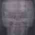 20110103171311-x-ray_self_portrait