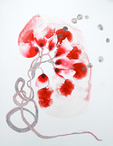 20110107131732-kidney