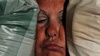 20110216224419-squeeze_1