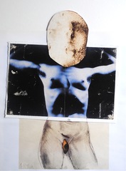 20110814084703-sap_cos-ahmet_homo-graft_2010