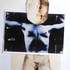 20110814084703-sap_cos-ahmet_homo-graft_2010