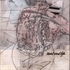 20110818173426-00000-moncktonexcavationpotential_wound_profile_-_angle_1_v1