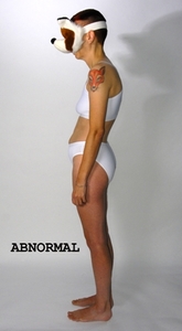 20110927040248-abnormal1sml