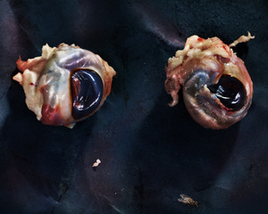 Blind ,Jill Greenberg