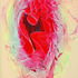 20120121221946-open_wound_healing