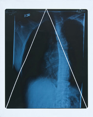 Self Portrait Torso #1,