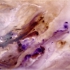 Ice_crystal