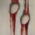 20120514160243-despitetherapiststouch