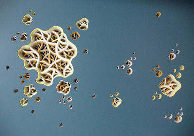 20120514195801-drug-a-diddle_cirrhosis__small_