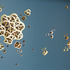 20120514195801-drug-a-diddle_cirrhosis__small_