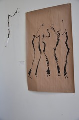 Kyphosis,Nancy D. Brown, Kristi Holohan