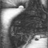 X_meditation-how_the_worm_works