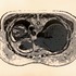 20121102052037-slice1