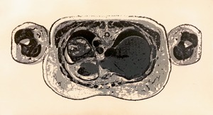 20121102052037-slice1