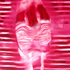 20130112165153-anatomicalsituationb