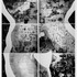 20130129183244-anamneza
