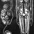 20130309164925-holocaust_anorexia_72
