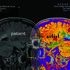 20130327045345-patient_artist_v8_postcard_copy