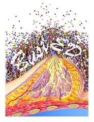 BustED: Art Around Breast Health,